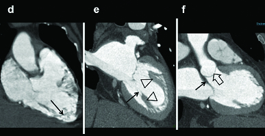 [Table/Fig-9]: