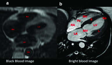 [Table/Fig-11a,b]: