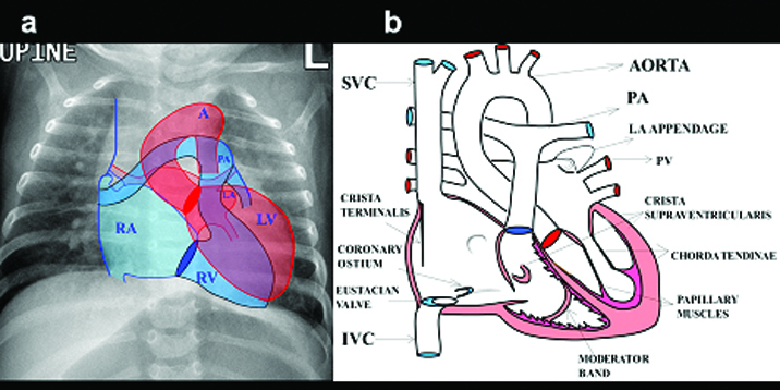 [Table/Fig-5a, 5b]: