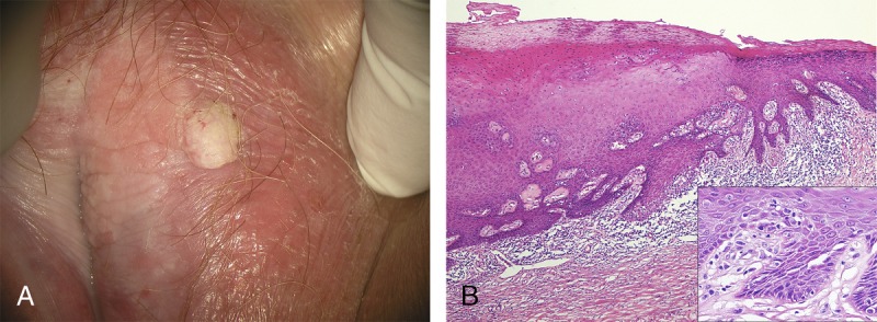 FIGURE 4