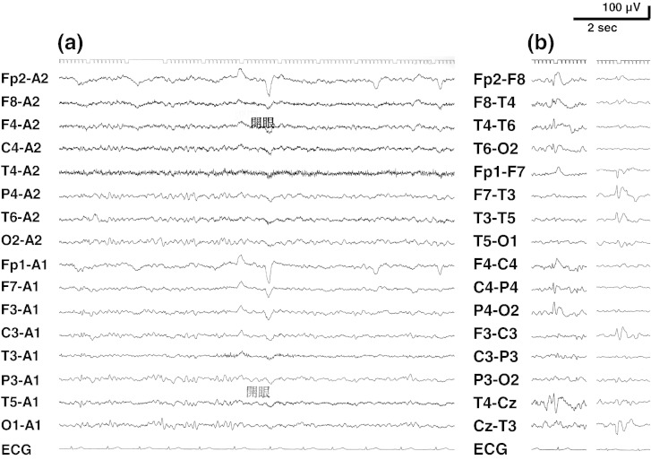 Fig. 1