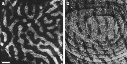 Fig. 14