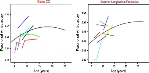 Fig. 13