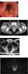 Fig. 1