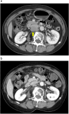 Fig. 4