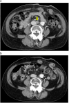 Fig. 3