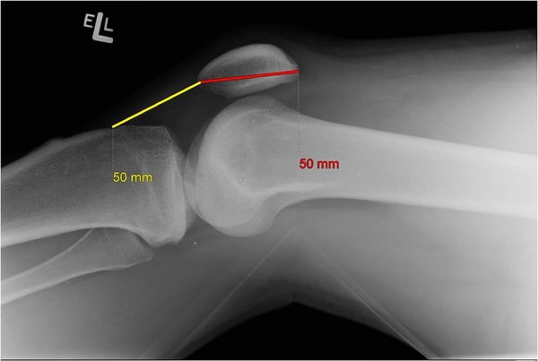 Figure 2