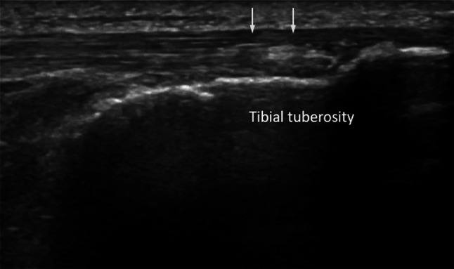 Fig. 5