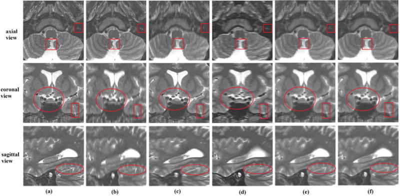 Fig. 6