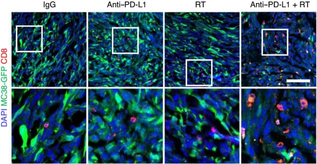 Figure 4. Liver metastasis induces systemic loss of antigen-specific T cells. Immunofluorescent staining of CD8+ cells in MC38 subcutaneous tumors from mice with subcutaneous tumors only or with subcutaneous and liver tumors. Analysis was done at 10 days after therapy initiation. Figure previously published in Nature Medicine (37); reprinted with permission.