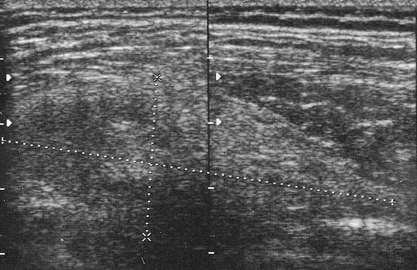 Fig.1