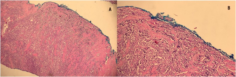 Figure 1A and 1B