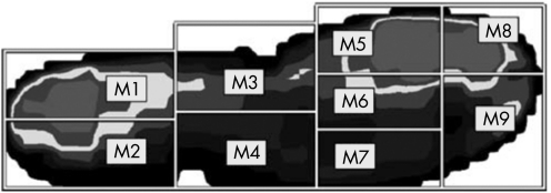 graphic file with name sm36707.f2.jpg