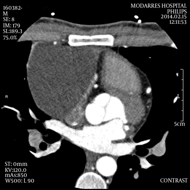 Figure 2.