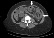 Figure 1: