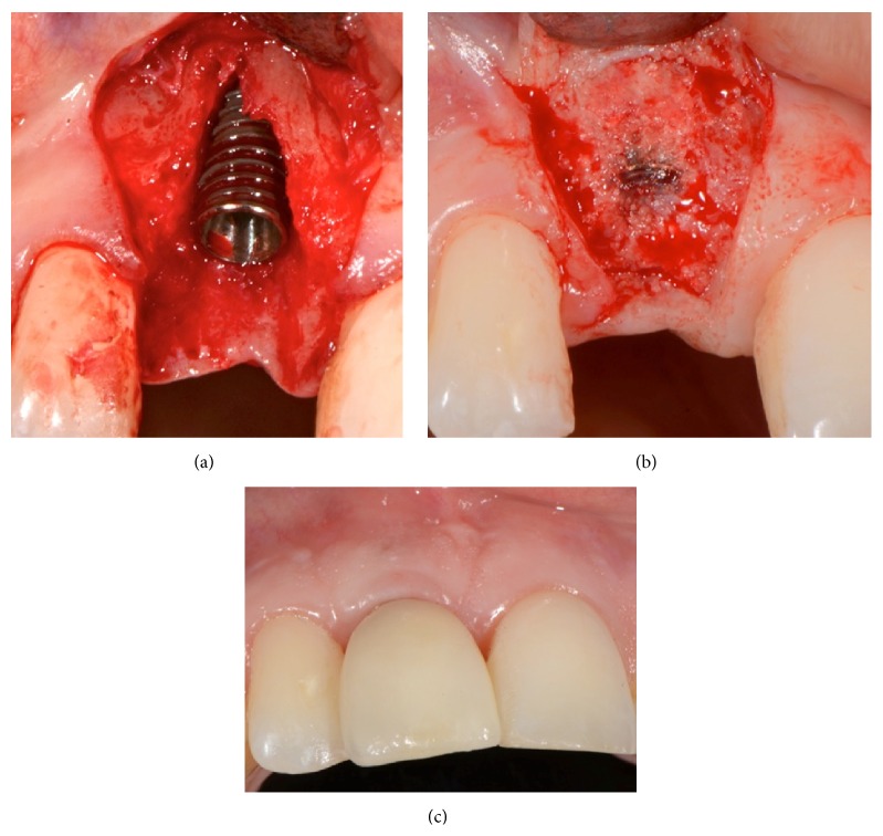 Figure 4