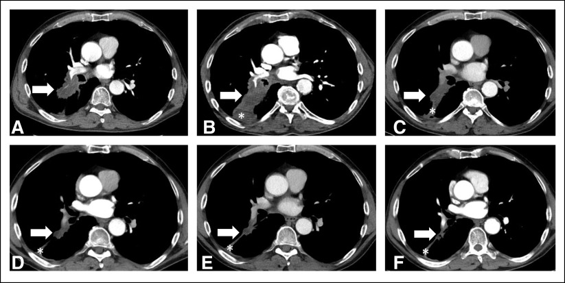 FIG 4.