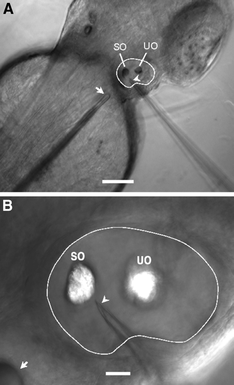 FIG. 1