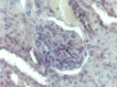 Fig 11