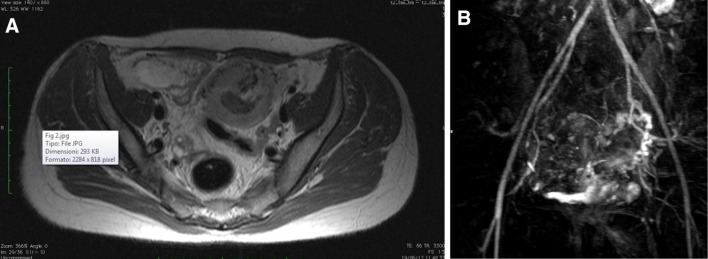 Fig. 2