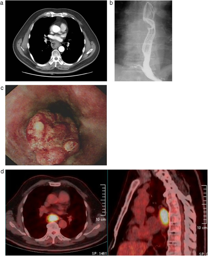 FIGURE 1