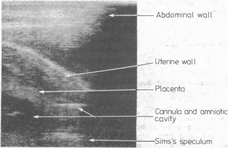 FIG 1