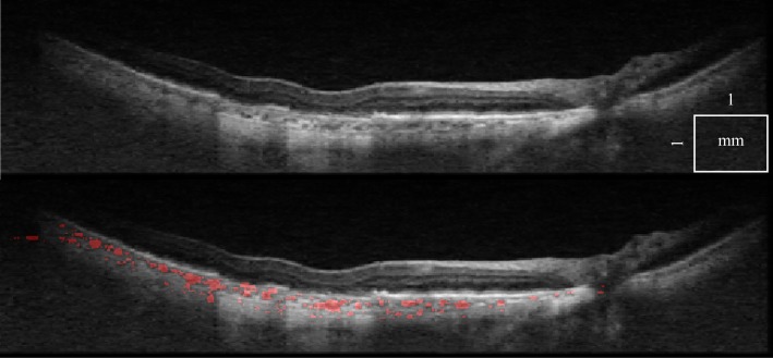 Fig. 11