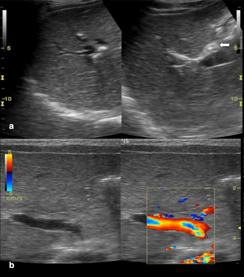 Fig. 12