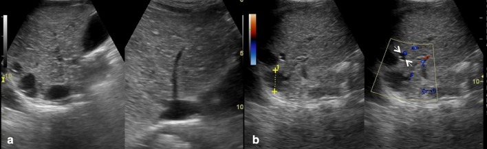 Fig. 11