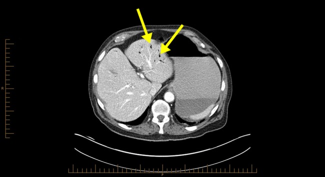 Figure 2: