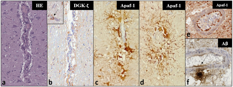 Fig 4