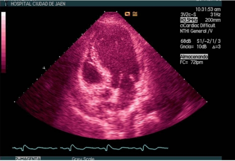 Fig. (1)