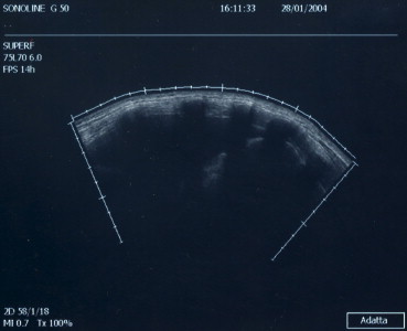 Fig. 1