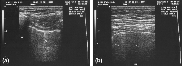 Fig. 5