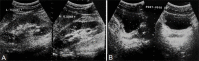 Figure 1(A, B)