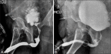 Figure 2(A, B)