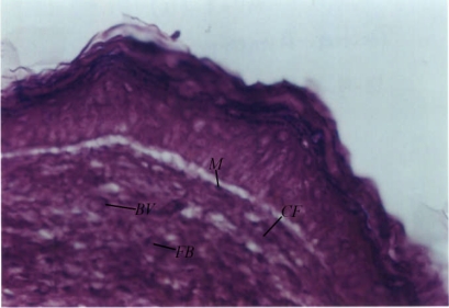 Figure 1B