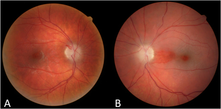 Fig. 2