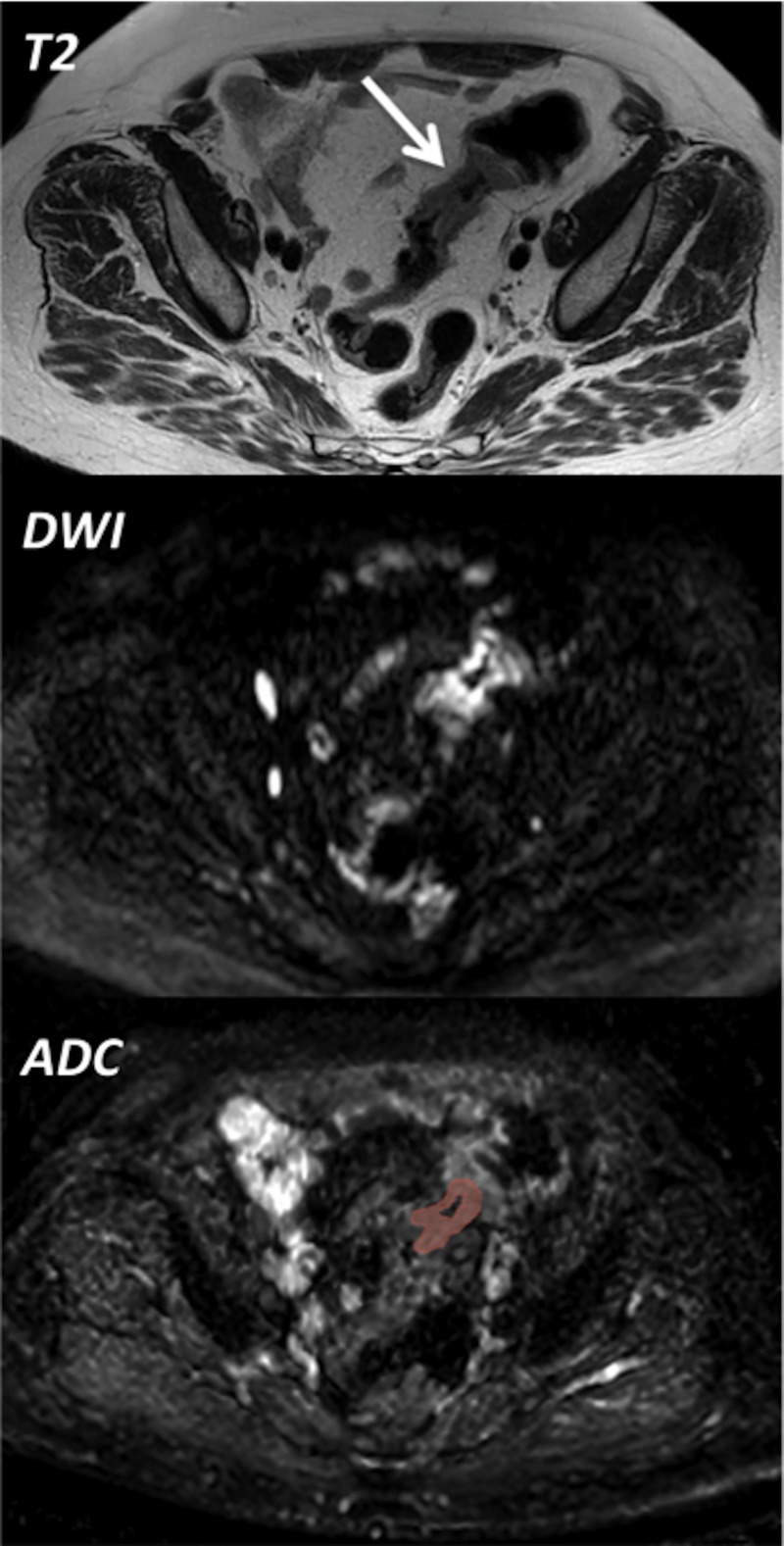 Fig 3