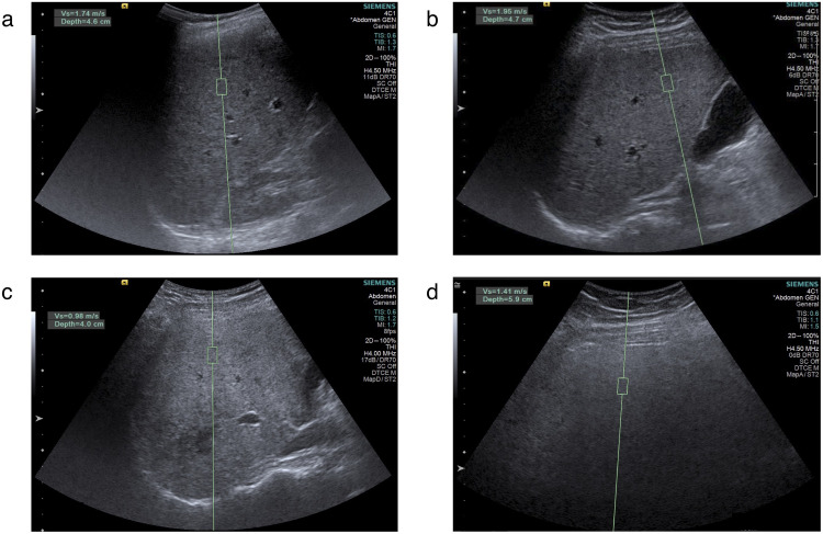 Fig 2