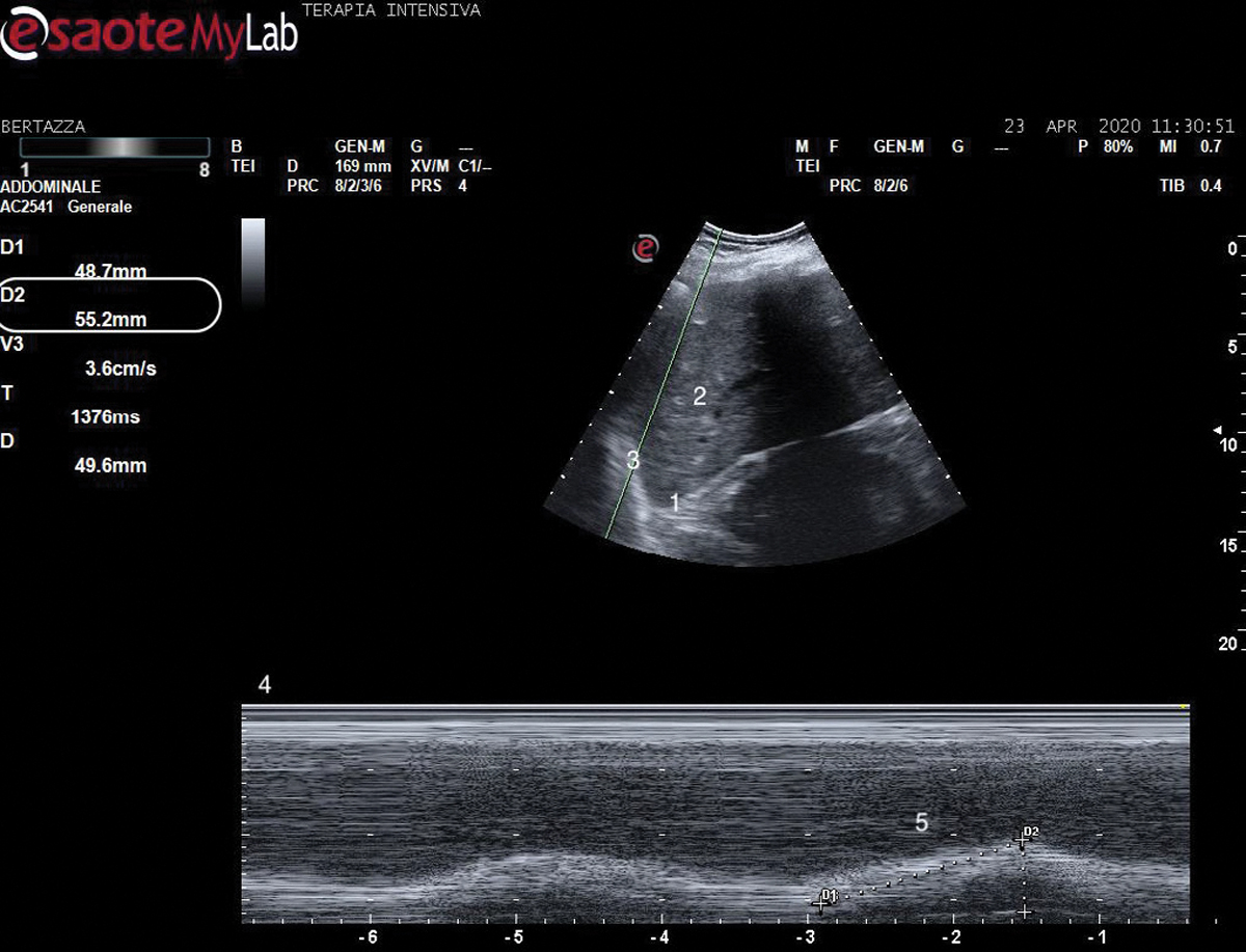 Figure 2: