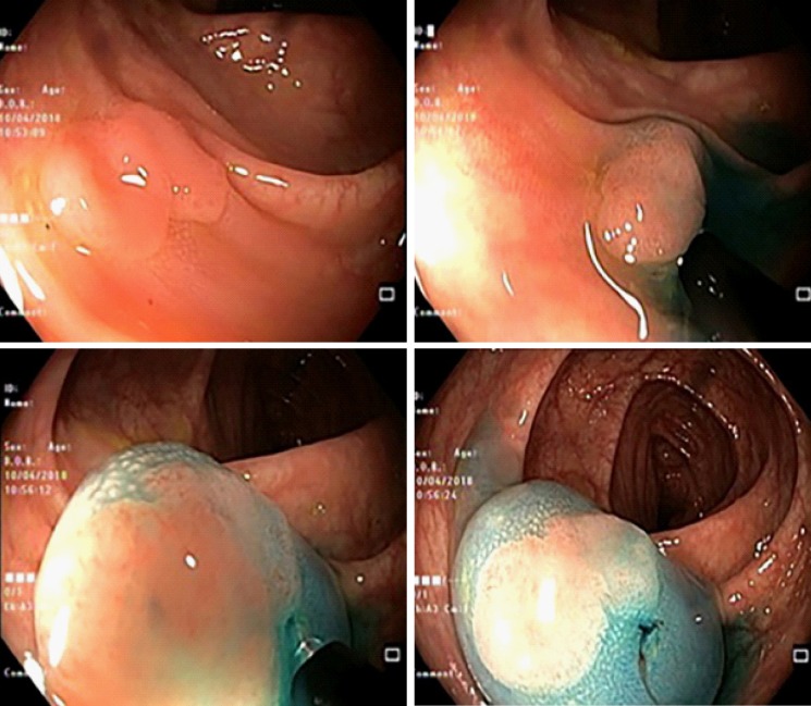 Figure 2