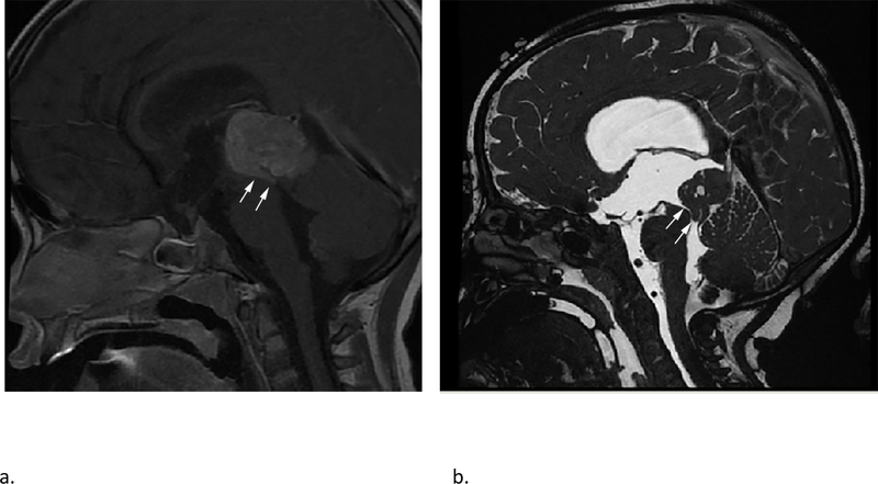 Fig 4 –