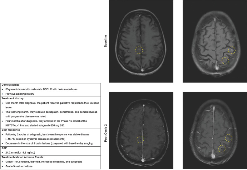 Figure 5. Case 2.