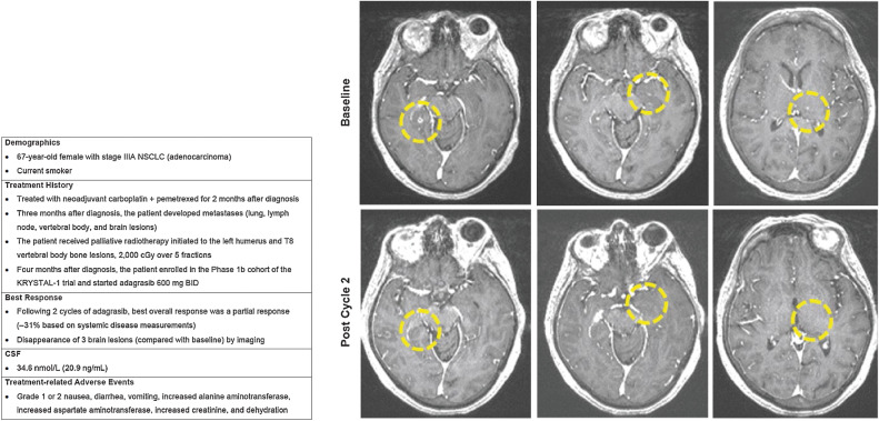 Figure 4. Case 1.