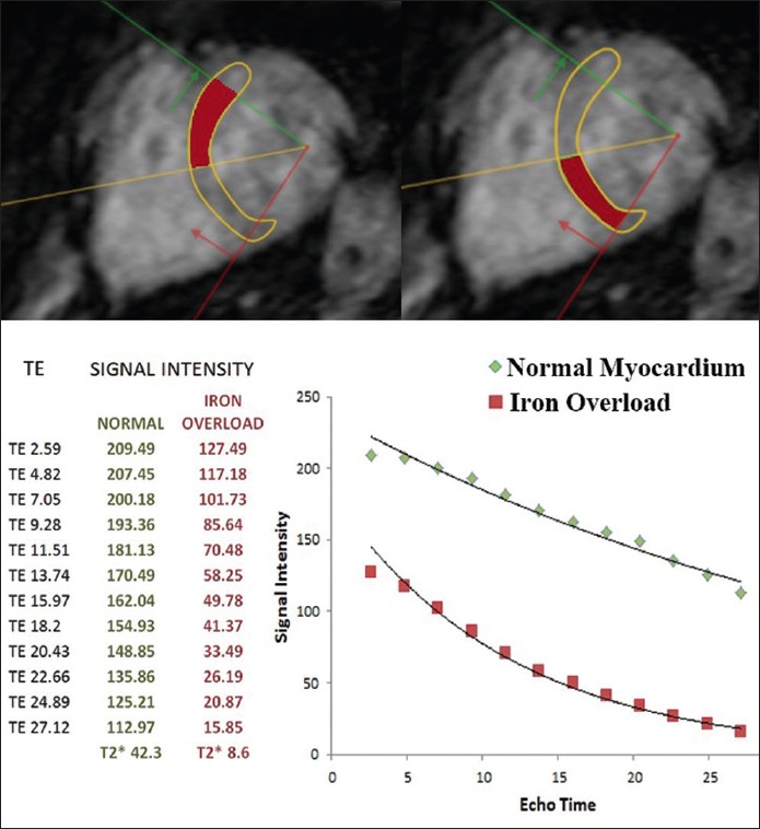 Figure 12