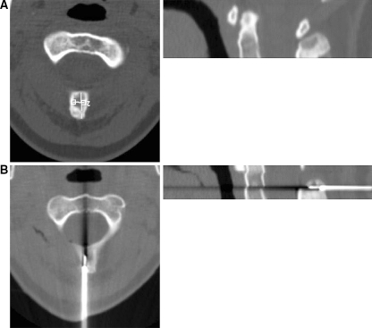 Fig. 4