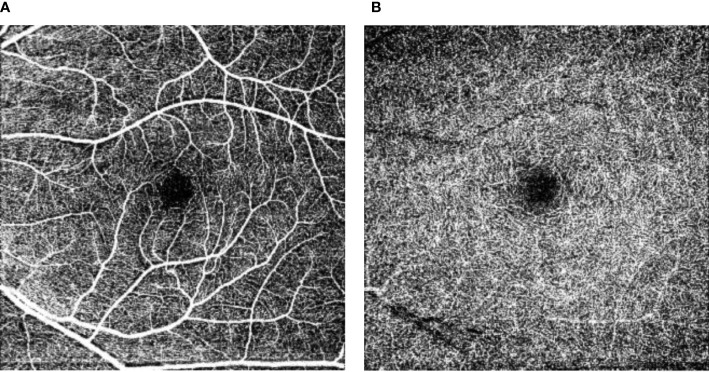 Figure 2.6