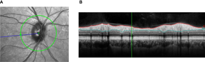 Figure 2.2