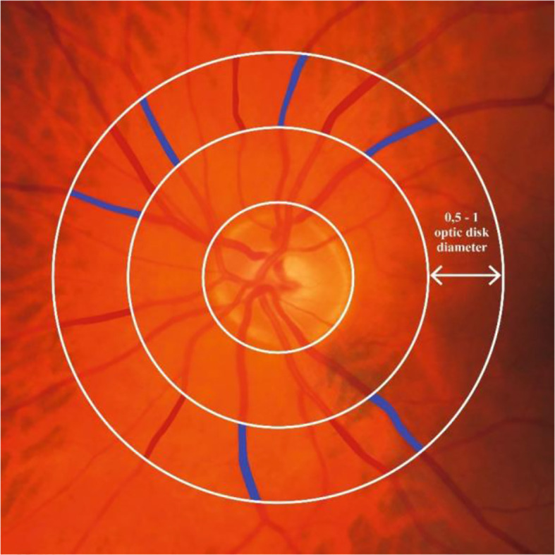 Figure 2.3